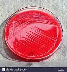 Iagrifarm Pseudomonas Fluorescens Powder - 2 Kg - for All Crops
